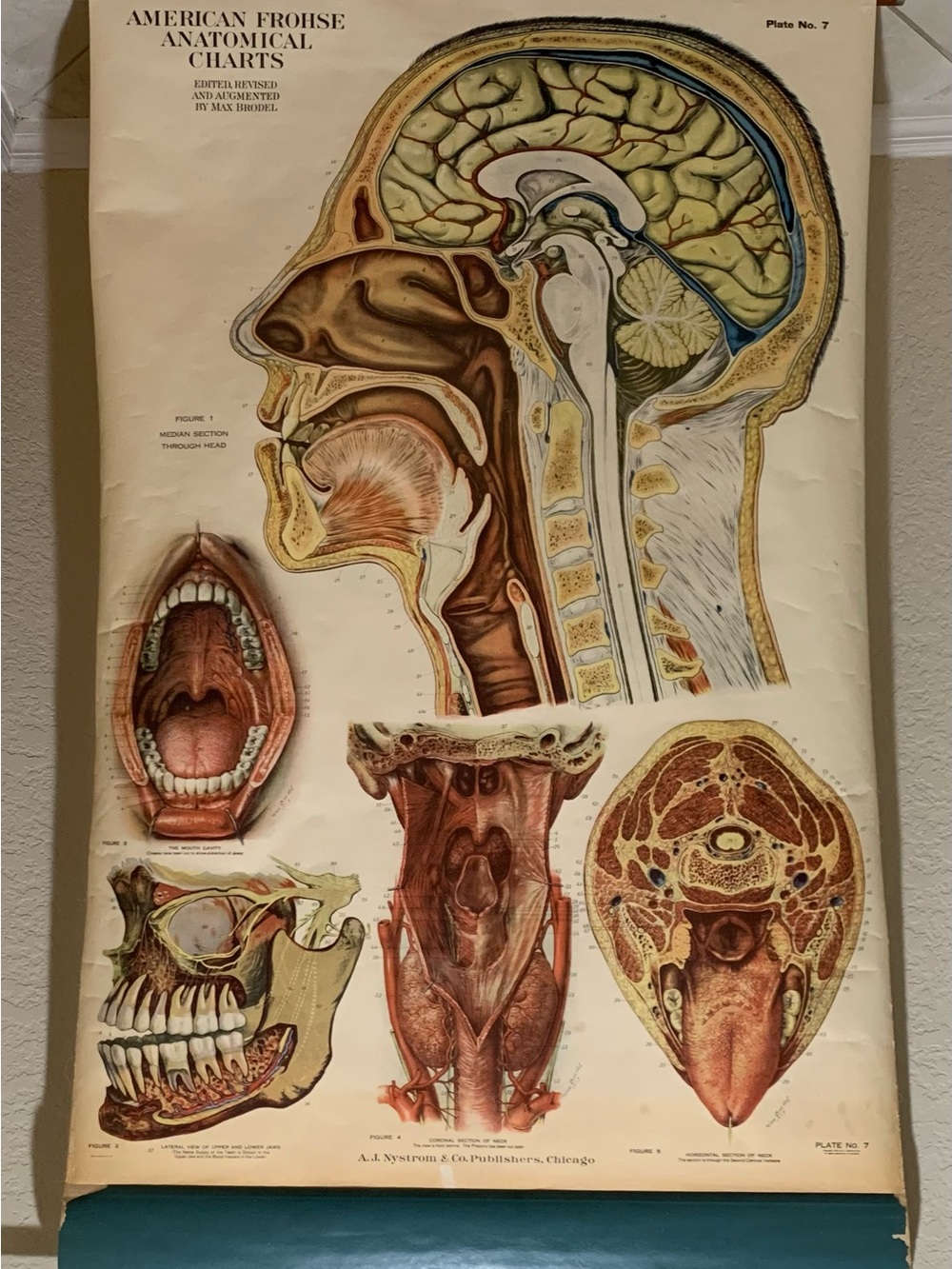 Antique American Frohse Anatomical Chart Head and Neck Signed Max Brotel 1919 - Picture 6 of 16